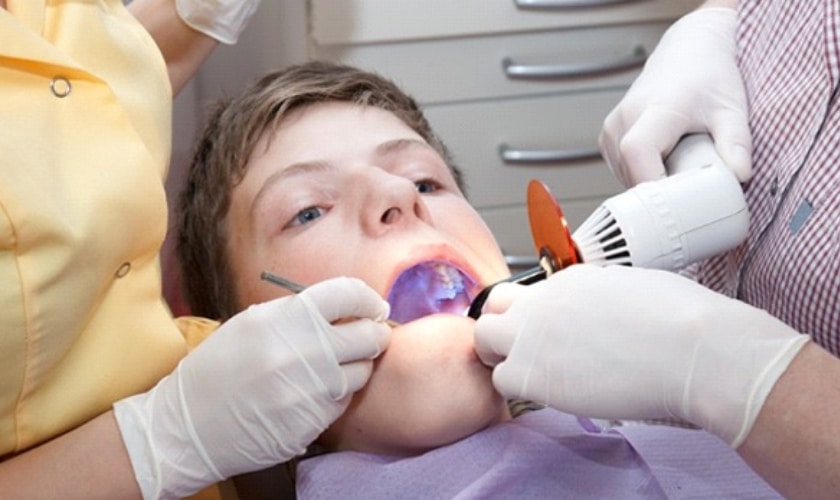 Dental Sealants in Rowlett Part 2: Evidence That Sealants Work!
