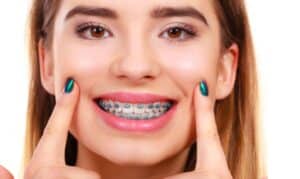 Orthodontic Treatment for Teens