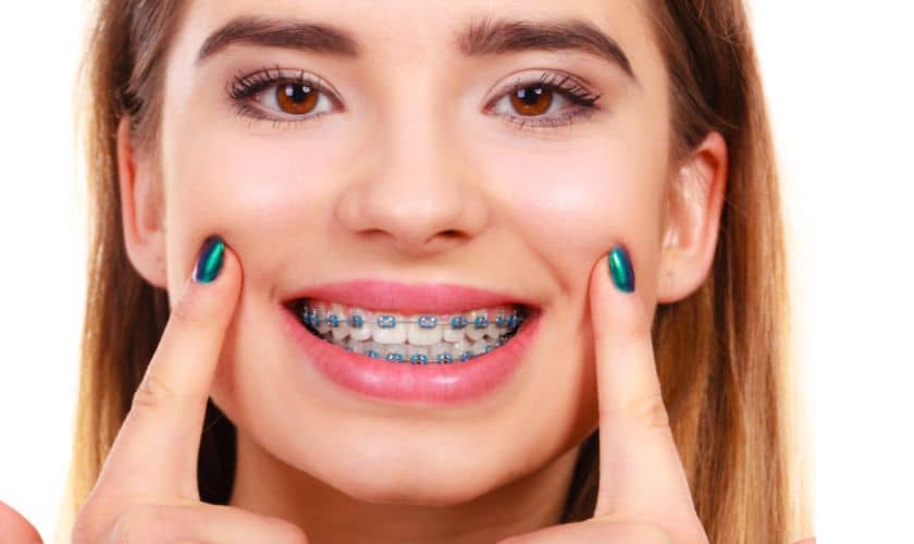 Braces or Aligners? Choosing the Best Orthodontic Treatment for Teens