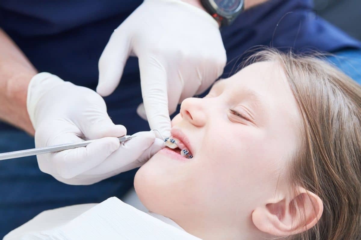 Preventive Measures for Common Orthodontic Problems in Children