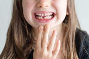 Children Typically Lose Their Baby Teeth