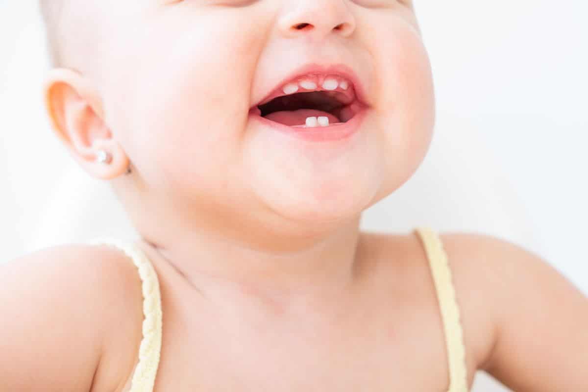 How Can I Treat Cavities in My Baby’s Teeth Naturally?