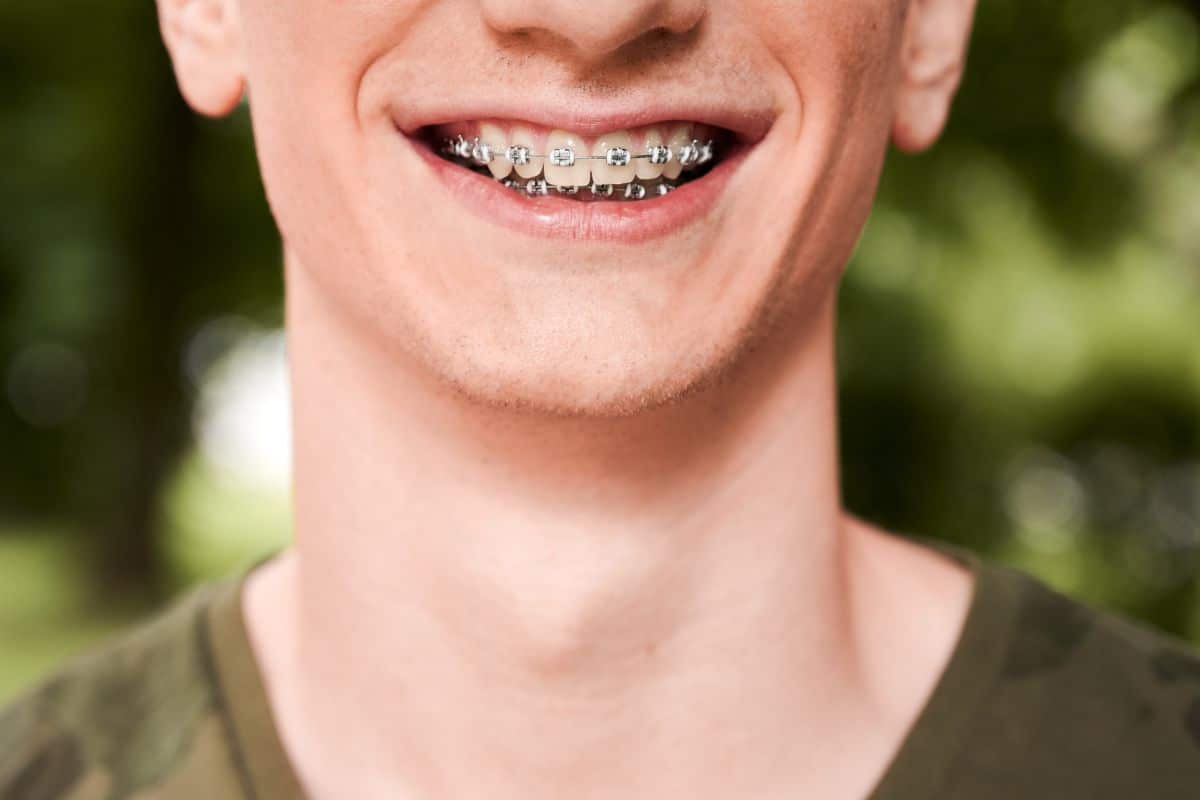 How Can You Know If Your Child’s Braces Are Effective? Signs the Treatment Is Working