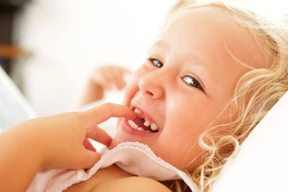 Do Cavities in Baby Teeth Really Need to Be Filled?