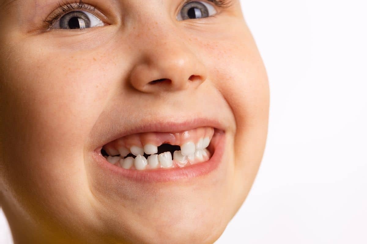 What Happens if a Baby Tooth Falls Out Too Early?